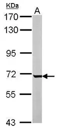 Anti-GCKR antibody [N1C3] used in Western Blot (WB). GTX103836