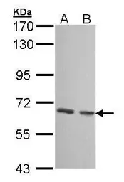 Anti-GCKR antibody [N1C3] used in Western Blot (WB). GTX103836
