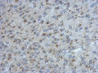 Anti-UGCGL2 antibody [N3C2], Internal used in IHC (Paraffin sections) (IHC-P). GTX103837