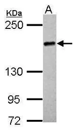 Anti-UGCGL2 antibody [N3C2], Internal used in Western Blot (WB). GTX103837