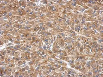 Anti-SLK antibody used in IHC (Paraffin sections) (IHC-P). GTX103840