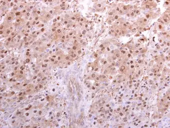 Anti-PSMA5 antibody used in IHC (Paraffin sections) (IHC-P). GTX103845