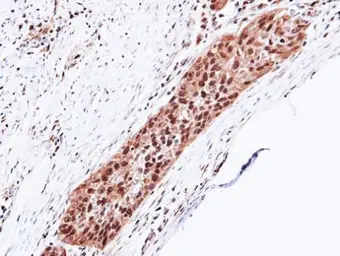 Anti-PSMA5 antibody used in IHC (Paraffin sections) (IHC-P). GTX103845