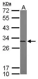 Anti-PSMA5 antibody used in Western Blot (WB). GTX103845