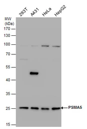 Anti-PSMA5 antibody used in Western Blot (WB). GTX103845