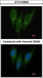 Anti-DNAJC1 antibody [C1C3] used in Immunocytochemistry/ Immunofluorescence (ICC/IF). GTX103858