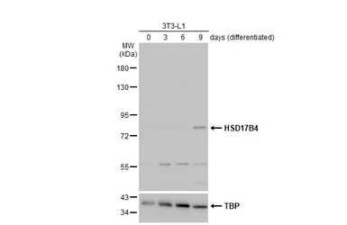 Anti-HSD17B4 antibody used in Western Blot (WB). GTX103864