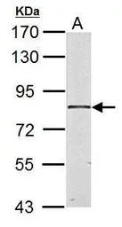 Anti-HSD17B4 antibody used in Western Blot (WB). GTX103864