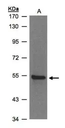 Anti-ZNF157 antibody [N3C3] used in Western Blot (WB). GTX103880