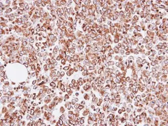 Anti-OAT antibody [N1C3] used in IHC (Paraffin sections) (IHC-P). GTX103893