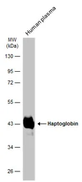 Anti-Haptoglobin antibody used in Western Blot (WB). GTX103894