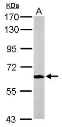Anti-MPP2 antibody [N1C3] used in Western Blot (WB). GTX103908