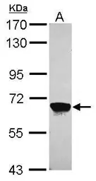Anti-MPP2 antibody [N1C3] used in Western Blot (WB). GTX103908
