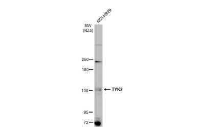 Anti-TYK2 antibody [C1C3] used in Western Blot (WB). GTX103938