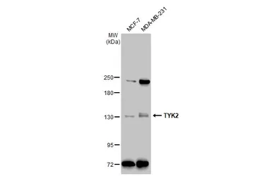 Anti-TYK2 antibody [C1C3] used in Western Blot (WB). GTX103938