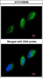 Anti-TYK2 antibody [C1C3] used in Immunocytochemistry/ Immunofluorescence (ICC/IF). GTX103938