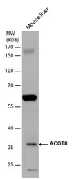 Anti-ACOT8 antibody [N1C3] used in Western Blot (WB). GTX103960