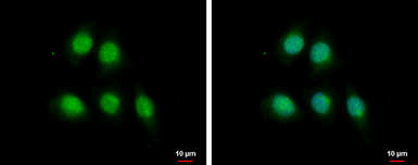 Anti-MAGE 1 antibody [N1C3] used in Immunocytochemistry/ Immunofluorescence (ICC/IF). GTX103961