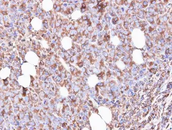 Anti-RPS3 antibody used in IHC (Paraffin sections) (IHC-P). GTX103964