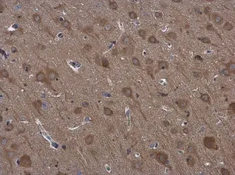 Anti-RPS3 antibody used in IHC (Paraffin sections) (IHC-P). GTX103964