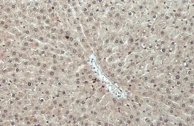 Anti-RPS3 antibody used in IHC (Paraffin sections) (IHC-P). GTX103964