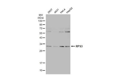 Anti-RPS3 antibody used in Western Blot (WB). GTX103964