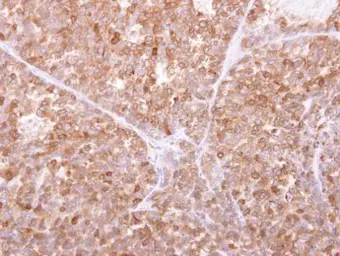 Anti-GILT antibody used in IHC (Paraffin sections) (IHC-P). GTX103967