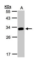 Anti-GILT antibody used in Western Blot (WB). GTX103967
