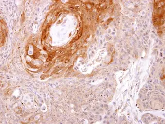 Anti-Prostasin antibody [N1C2] used in IHC (Paraffin sections) (IHC-P). GTX103976