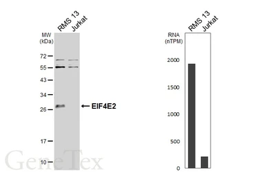 Anti-EIF4E2 antibody [N1C3] used in Western Blot (WB). GTX103977