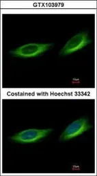 Anti-TULP1 antibody [C1C3] used in Immunocytochemistry/ Immunofluorescence (ICC/IF). GTX103979