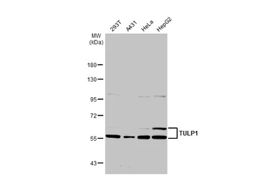 Anti-TULP1 antibody [C1C3] used in Western Blot (WB). GTX103979