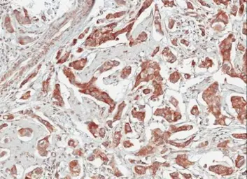 Anti-TULP1 antibody [C1C3] used in IHC (Paraffin sections) (IHC-P). GTX103979