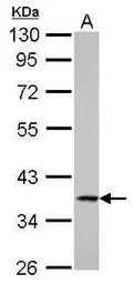 Anti-Cathepsin S antibody used in Western Blot (WB). GTX103988