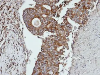 Anti-Cathepsin S antibody used in IHC (Paraffin sections) (IHC-P). GTX103988
