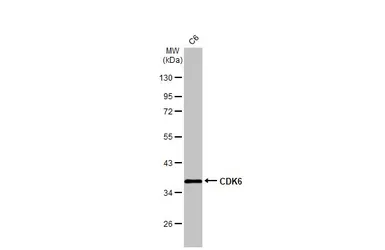 Anti-CDK6 antibody [N1C3] used in Western Blot (WB). GTX103992