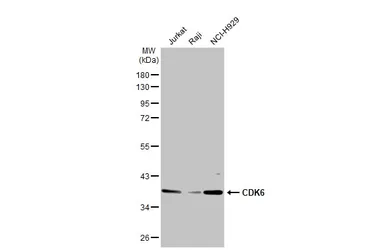 Anti-CDK6 antibody [N1C3] used in Western Blot (WB). GTX103992