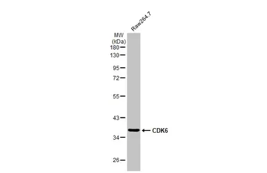 Anti-CDK6 antibody [N1C3] used in Western Blot (WB). GTX103992
