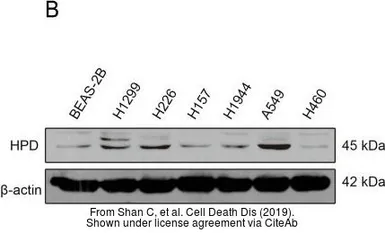 Anti-HPD antibody [N1C2] used in Western Blot (WB). GTX103994