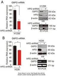 Anti-HPD antibody [N1C2] used in Western Blot (WB). GTX103994