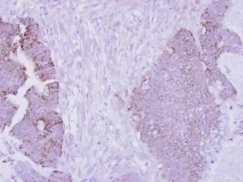 Anti-ARG2 antibody used in IHC (Paraffin sections) (IHC-P). GTX104036