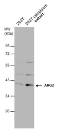 Anti-ARG2 antibody used in Western Blot (WB). GTX104036