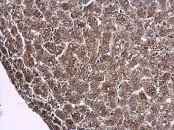 Anti-ARG2 antibody used in IHC (Paraffin sections) (IHC-P). GTX104036