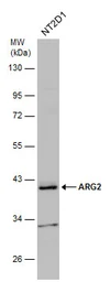 Anti-ARG2 antibody used in Western Blot (WB). GTX104036