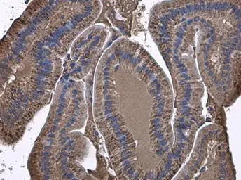 Anti-ARG2 antibody used in IHC (Paraffin sections) (IHC-P). GTX104036