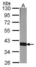 Anti-Cyclophilin 40 antibody used in Western Blot (WB). GTX104038