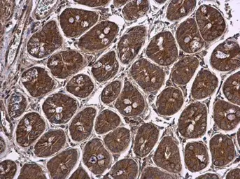 Anti-Pyruvate Dehydrogenase E1 beta subunit antibody used in IHC (Paraffin sections) (IHC-P). GTX104040