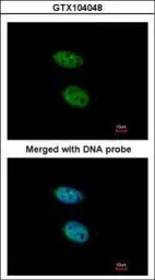 Anti-PRPS2 antibody [N1C3] used in Immunocytochemistry/ Immunofluorescence (ICC/IF). GTX104048