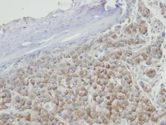 Anti-PRPS2 antibody [N1C3] used in IHC (Paraffin sections) (IHC-P). GTX104048