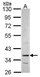 Anti-PRPS2 antibody [N1C3] used in Western Blot (WB). GTX104048
